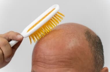 How diet, hormones and inflammation may contribute to hair loss